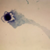 NK細胞に働きかけるレンチンコップ