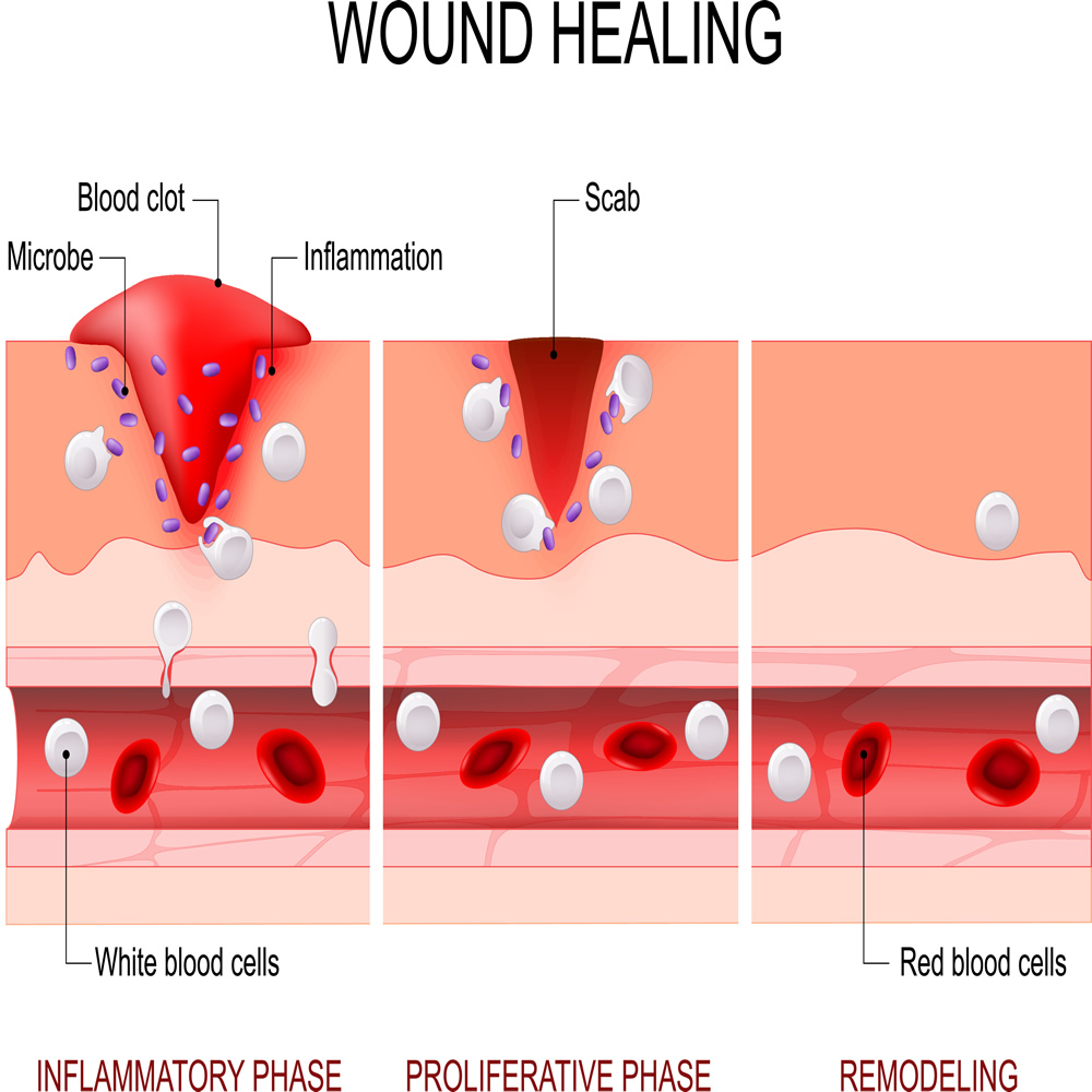 WOUND HEALING